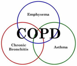 COPD diagram: Emphysema, Chronic Bronchities and Asthma