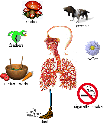 Diagram of bronchi and environmental allergens